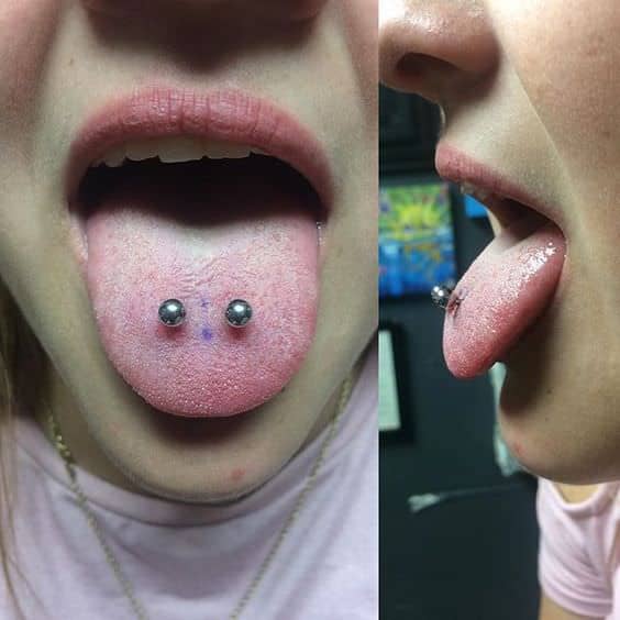Dental Issues Tongue Piercing Can Cause 
